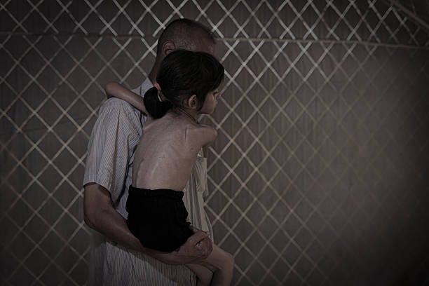 Five-year-old Lana Salih Juha, who fled with her family from Gaza's Shuja'iyya neighborhood to the city center, suffers from severe malnutrition...