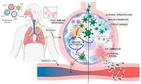 Combating Emerging Respiratory Viruses: Lessons and Future ...