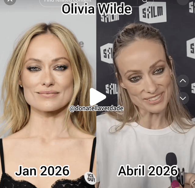 r/LAinfluencersnark - These pics are just months apart. What is going on in Hollywood? She is very emaciated now