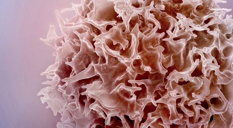 Coloured scanning electron micrograph (SEM) of a T lymphocyte (T cell) that resembles a large crumpled ball of tissue paper.