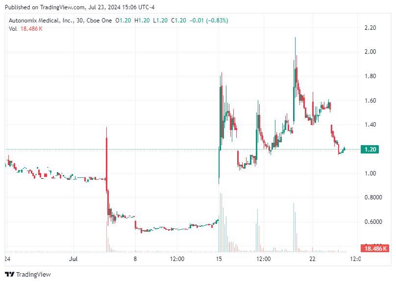 TradingView chart TradingView chart
