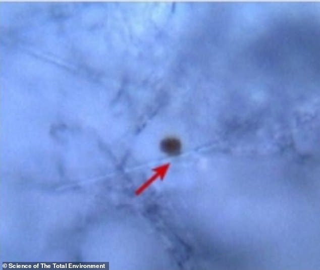 Tiny bits of microplastic, seen here as the black dots, were found in the semen samples of all 36 participants in a Chinese trial