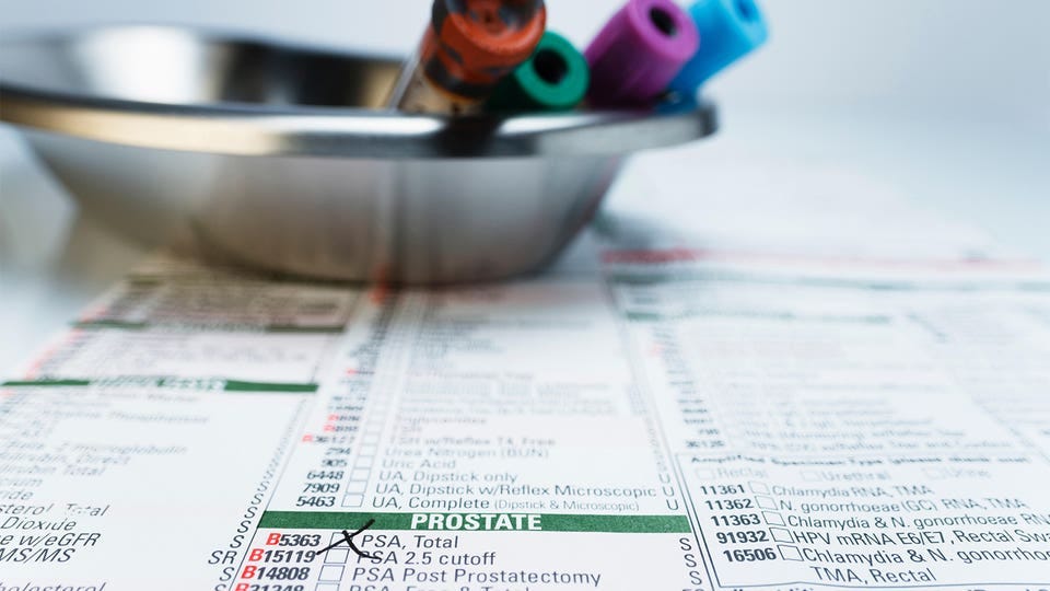A photo of a bowl of test tubes of blood laying on a test form with PSA, Total checked off.