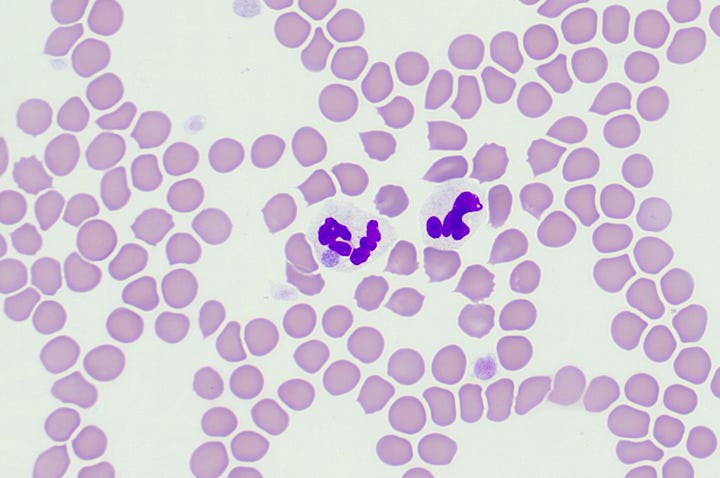 Anaplasma phagocytophilum morulae in neutrophils of dogs and cats on a peripheral blood smear northeast USA