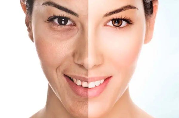 Skin hack thyronine