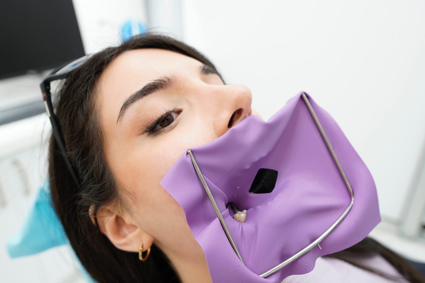 rubber dam being used on patient