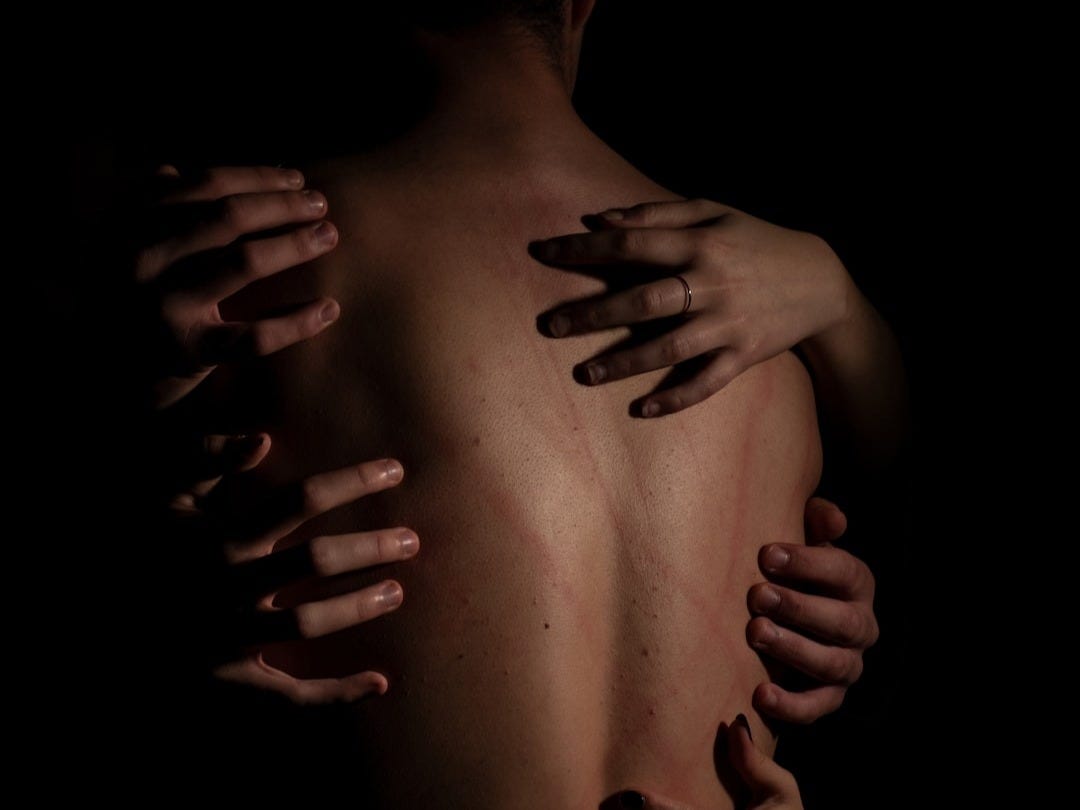 New Hope For Dermatitis Patients Amidst This New Drug Development