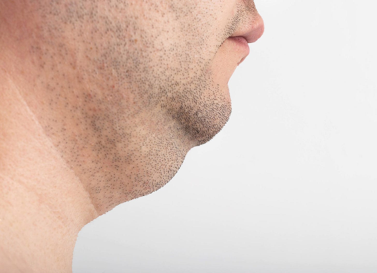 Treating Double Chin, Skin Conditions & Skin Concerns