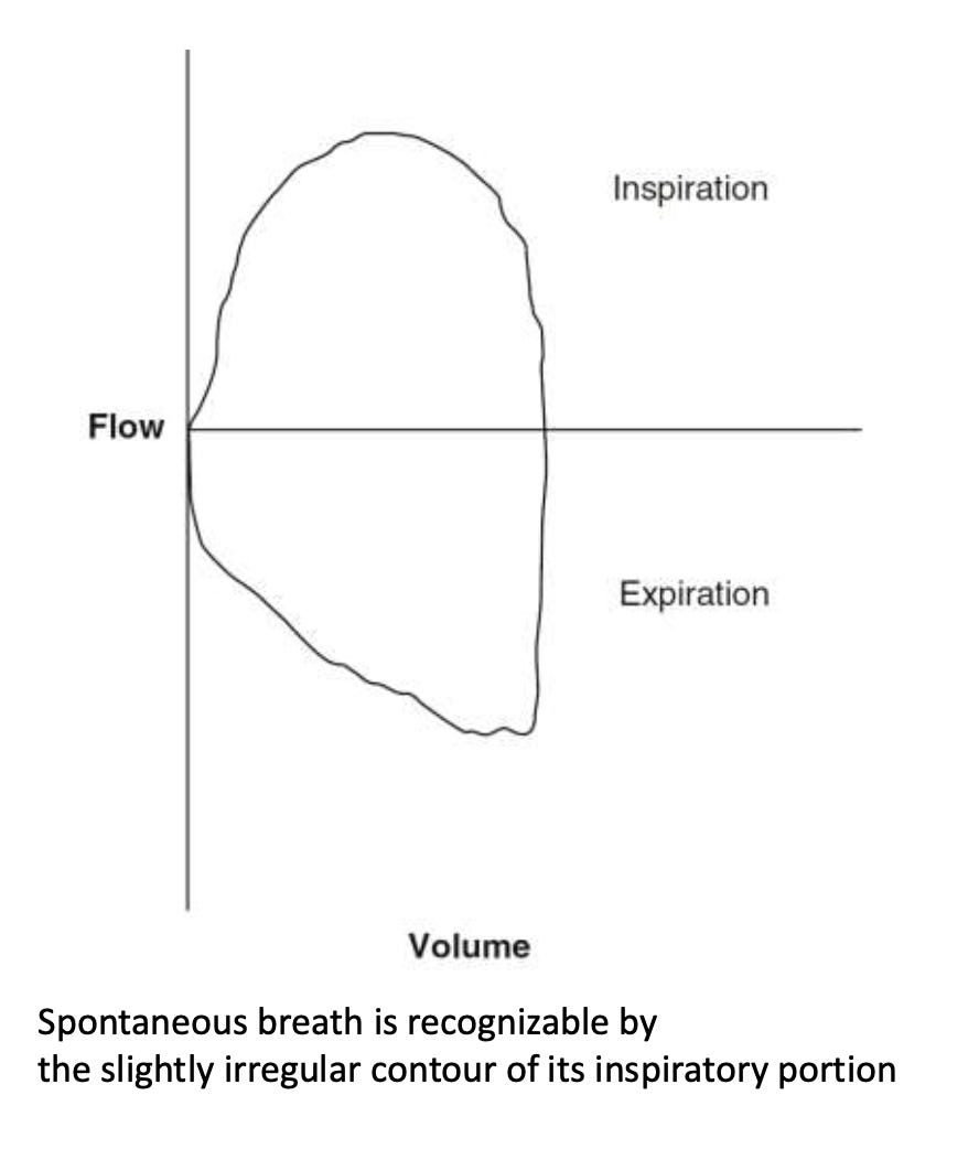 The Ventilator Screen Decoded — Part 2