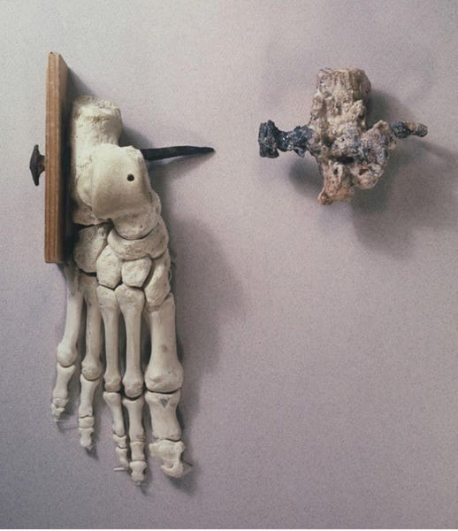 This Bone Is The Only Skeletal Evidence For Crucifixion In The Ancient World