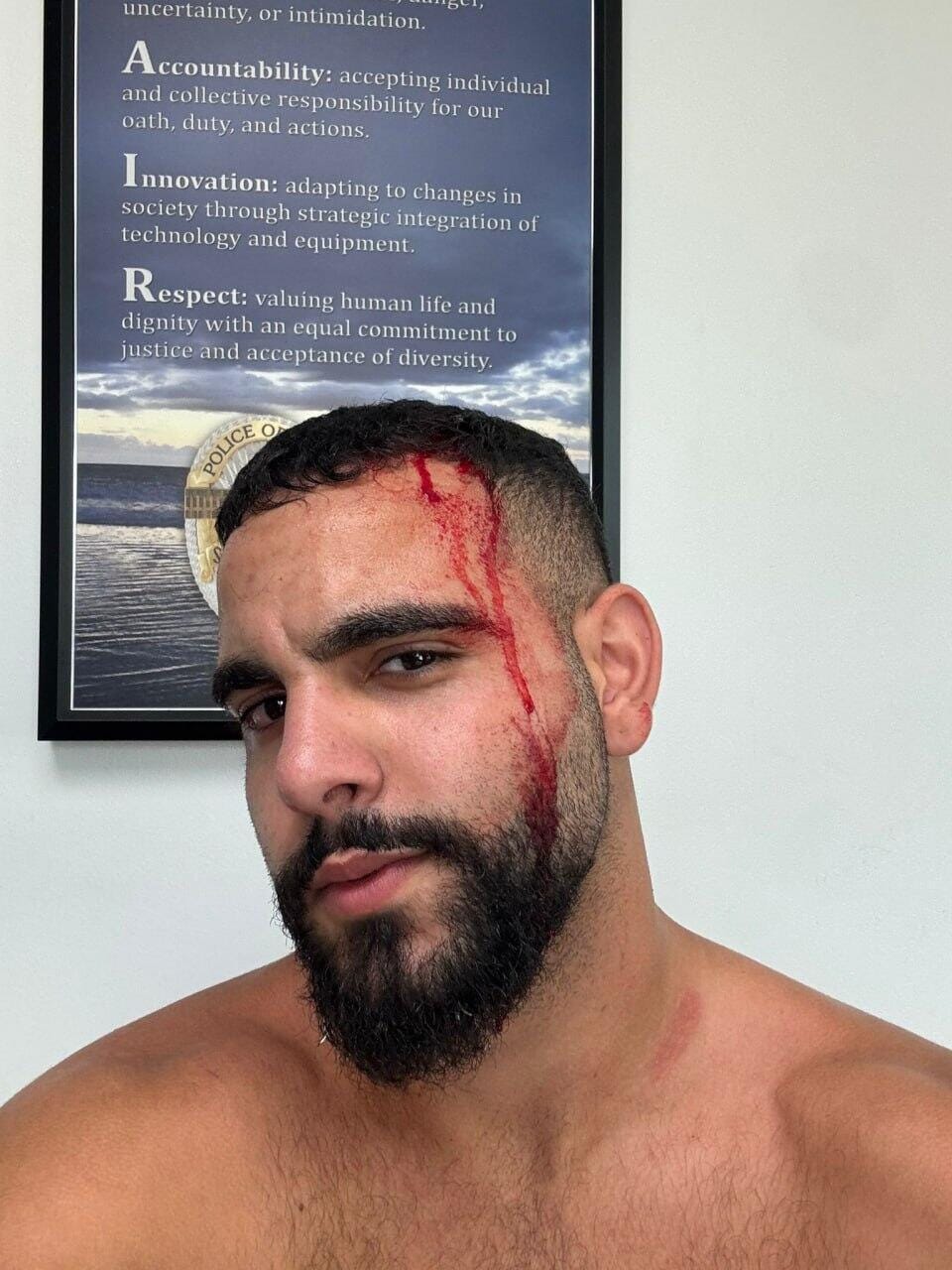 Israeli man attacked by pro-Palestinian crowd in Los Angeles Israeli man attacked by pro-Palestinian crowd in Los Angeles