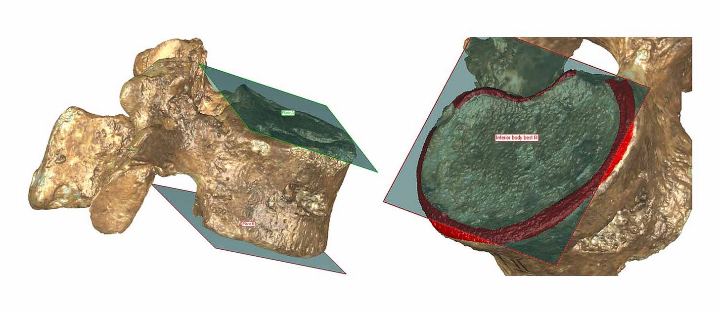 A vertebra showing a plane being fit to the ring around the vertebral body