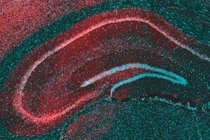 This microscope image of the brain region called the hippocampus shows the protein targeted by cannabis-derived CBD, GPR55 (red), and brain cells (blue) that send their extensions out to form the layers seen in the image. The interconnected nature of the hippocampus makes it a major site of for the initiation and spread of seizures.