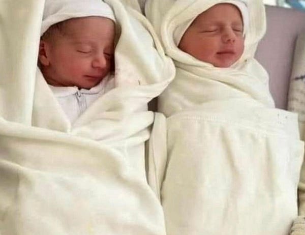 Twins Ayser and Aysal Abu al-Qumsan Twins Ayser and Aysal Abu al-Qumsan
