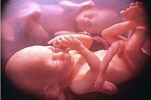 babyUnborn babyUnborn