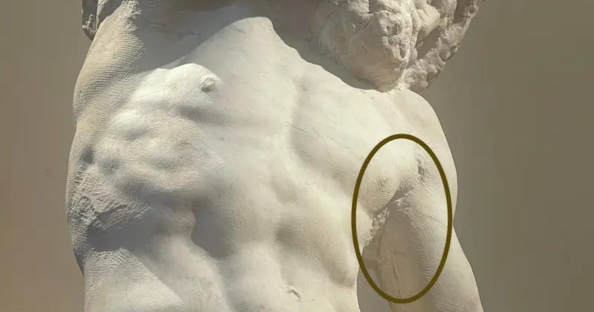 A Michelangelo Sculpture May Hold the Earliest Image of a Disease Named Three Centuries Later A Michelangelo Sculpture May Hold the Earliest Image of a Disease Named Three Centuries Later