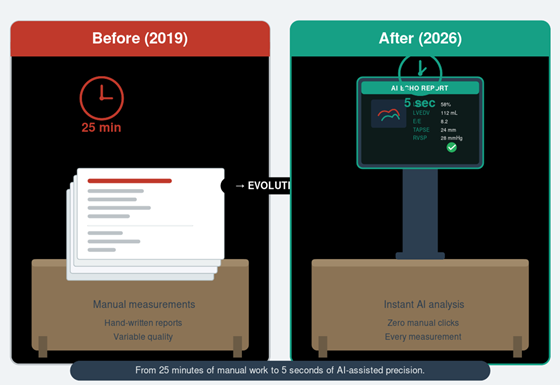 Echo reading before and after AI – from 20 minutes to seconds