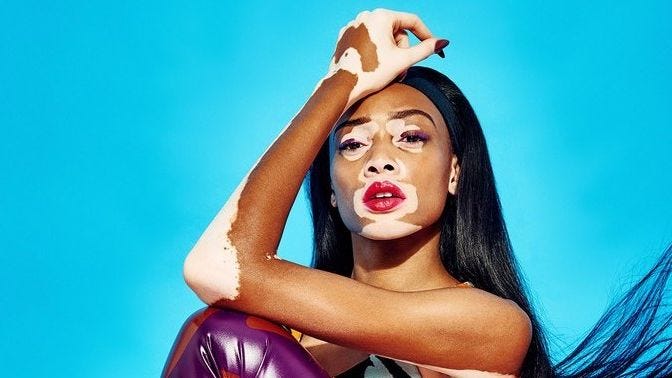 Winnie Harlow