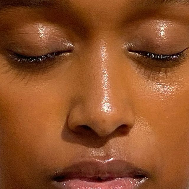 People Told Me I Had Perfect Skin, But I Could Never See it