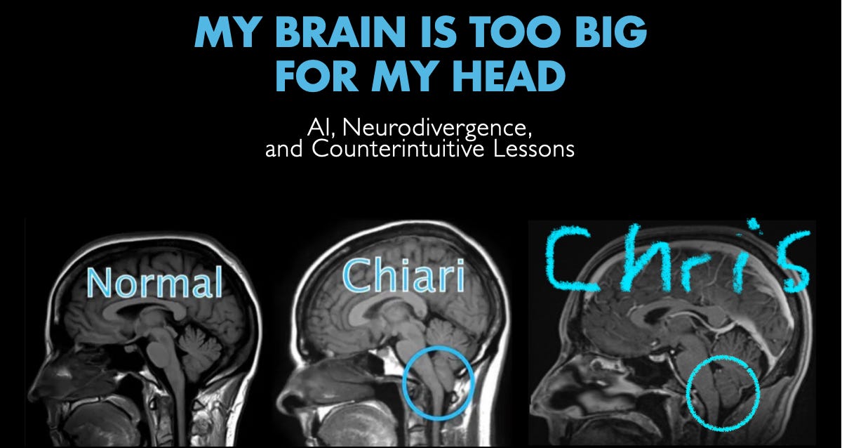 Chiari Malformation PNG | “MY BRAIN IS TOO BIG FOR MY HEAD: AI, Neurodivergence, and Counterintuitive Lessons” Chris Carnell
