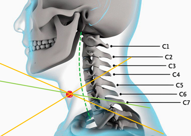 A skeleton of a person's neck

AI-generated content may be incorrect.