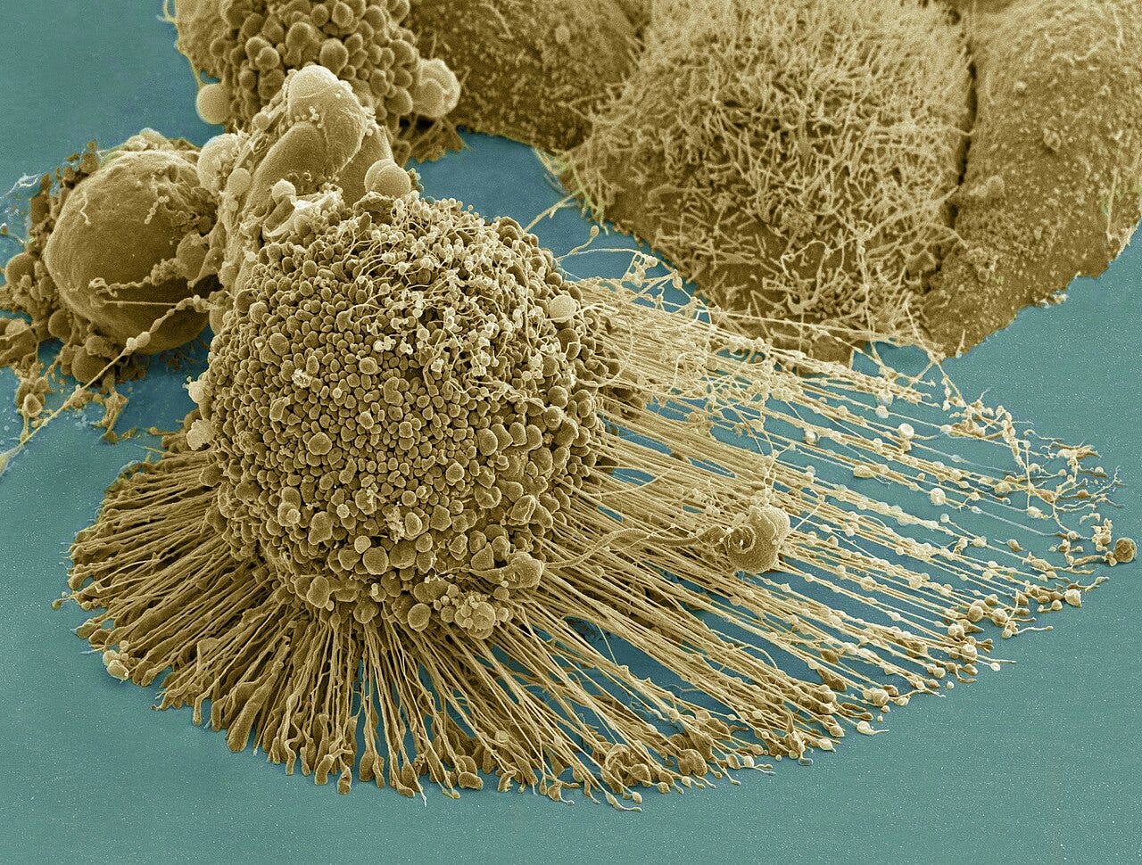 Description: Scanning electron micrograph of an apoptotic HeLa cell. Zeiss Merlin HR-SEM. Categories: Research in NIH Labs and Clinics Type: Color, Photo Source: National Institutes of Health (NIH) Date Created: 2013