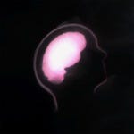 “Trauma,” a detail from “Disabled Warrior,” by the author. A fanciful xray of a human skull showing a glowing brain inside.