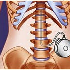 ABCs of multiple sclerosis 