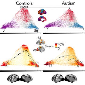 Neurodivergence: A System-Level Account Of The Autistic Brain