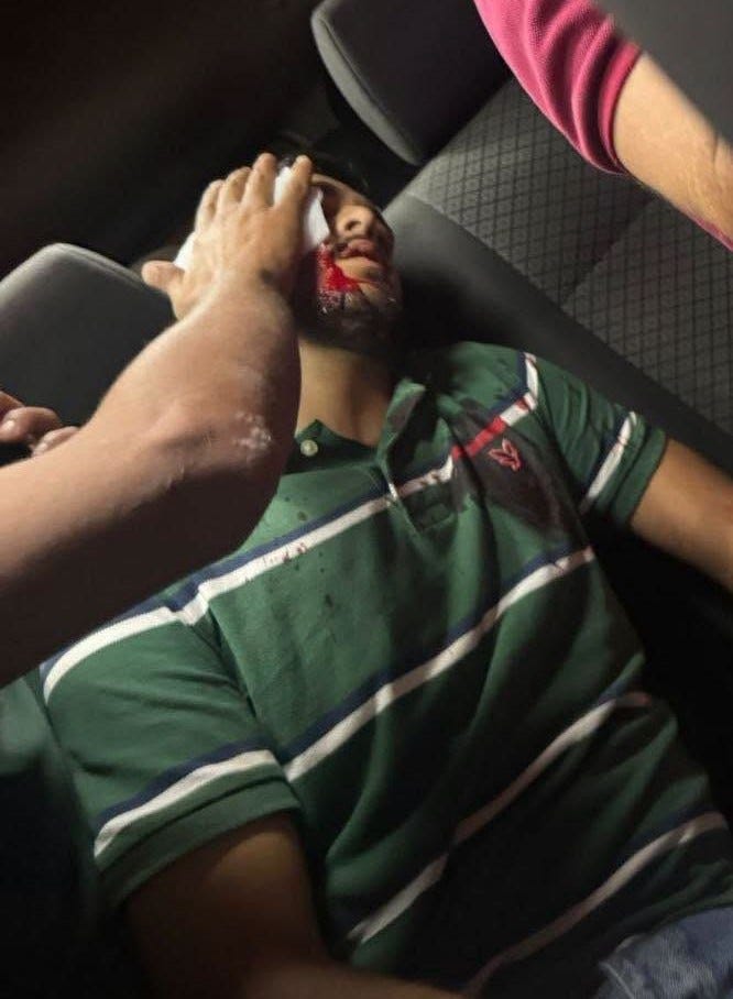 🚨 WEST BANK ALERTS — Reckless Targeting of Civilians: Returning Worker Mohammad Samhan Hospitalized with Concussion After Rubber Bullet Headshot