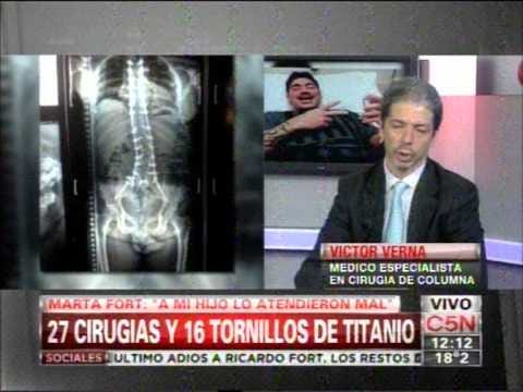 C5N - SOCIEDAD: FORT 27 CIRUGIAS Y 16 TORNILLOS DE TITANIO (PARTE 1)