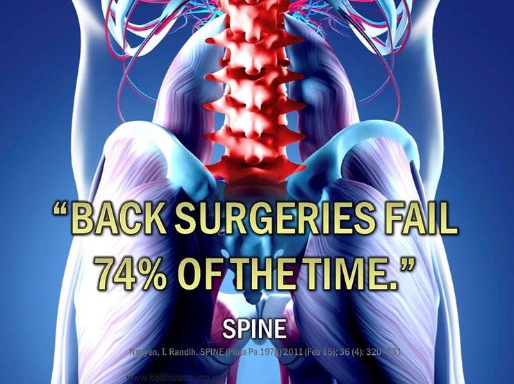74% Failure of Back Surgery 