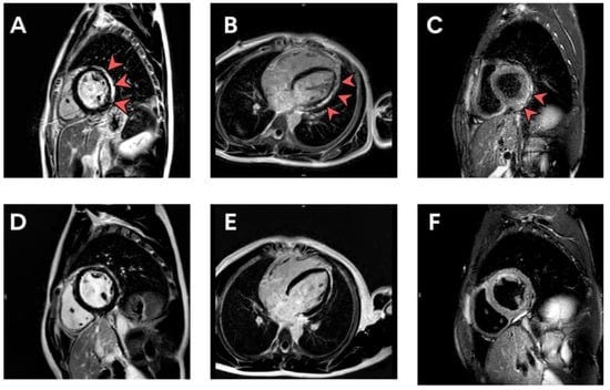 Tropicalmed 07 00196 g002 550