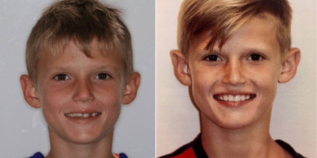 Myofunctional Therapy