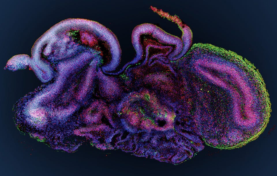 Human Brain Organoids | Key Discovery | Vienna BioCenter