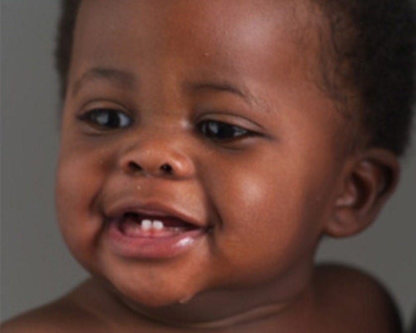 Teething in Babies: What African Parents Should Know