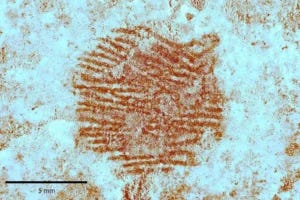 Dermatoglyphic image obtained by the multispectral analysis of the red dot