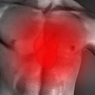 Fibromyalgia as a Dopamine Deficiency Condition