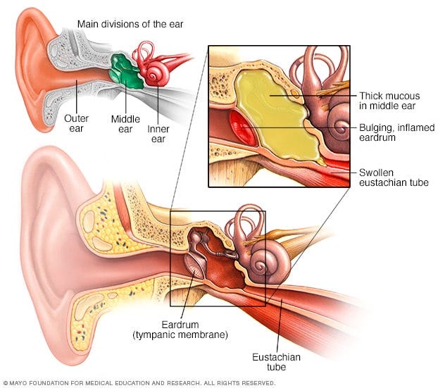 Ear infection Ear infection