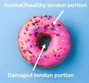 Tendons: Springing into Action - Mariska Odendaal ...