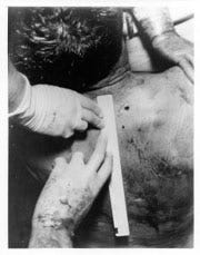 How Five Investigations into JFK's Medical/Autopsy Evidence Got it Wrong -  Discussion