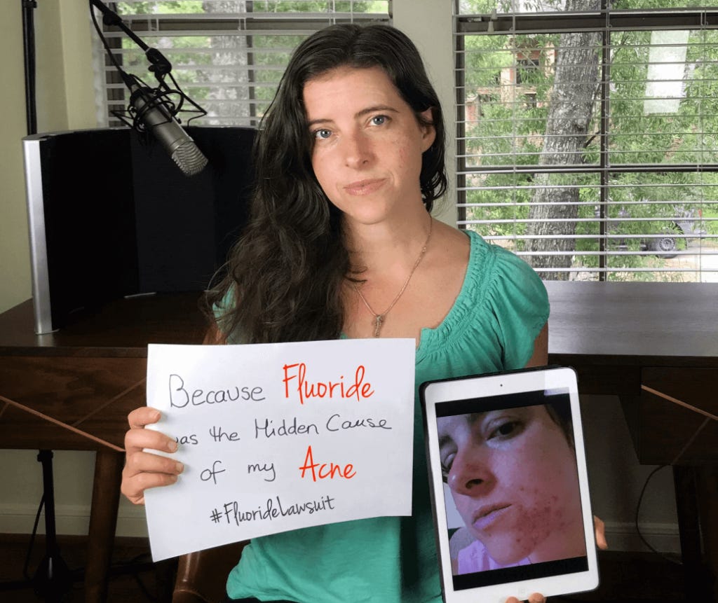 Hypersensitive Reactions to Topical Fluorides