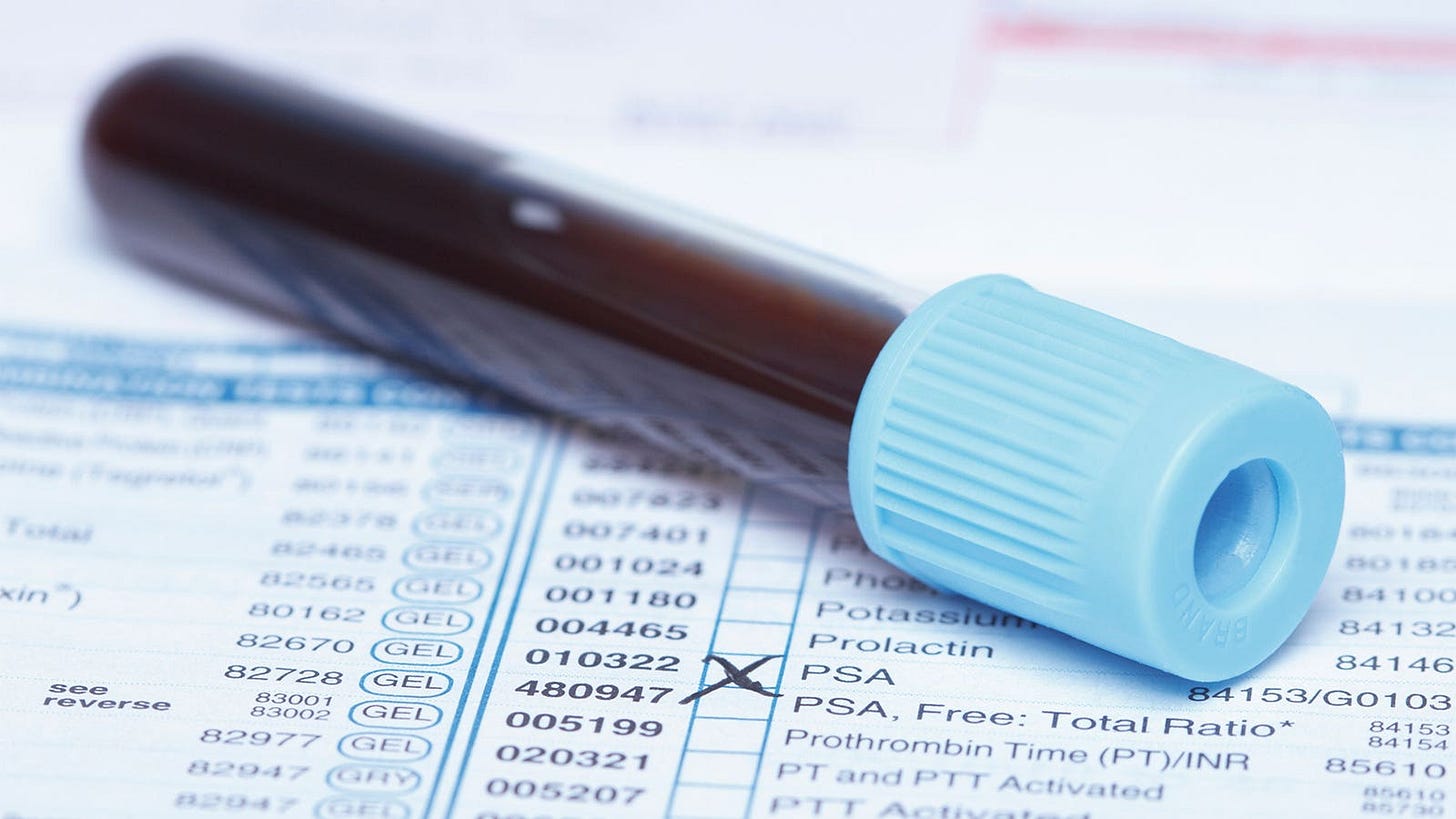 A photo of a test tube of blood laying on a test form with the box next to PSA checked.