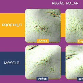 Sabendo ISTO, ainda vale a pena o tratamento com o Profhilo®?