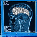 Issue #381: Betting Your Life on The Rehearsal