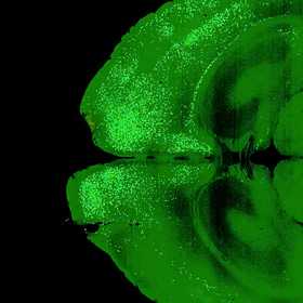 Depression is a disease of neurons as much as traffic is a disease of cars. 