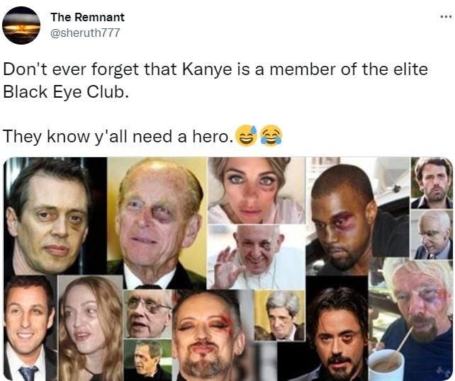 The Remnant @sheruth777 Don't ever forget that Kanye is a member of the elite Black Eye Club. They know y'all need a hero. ...