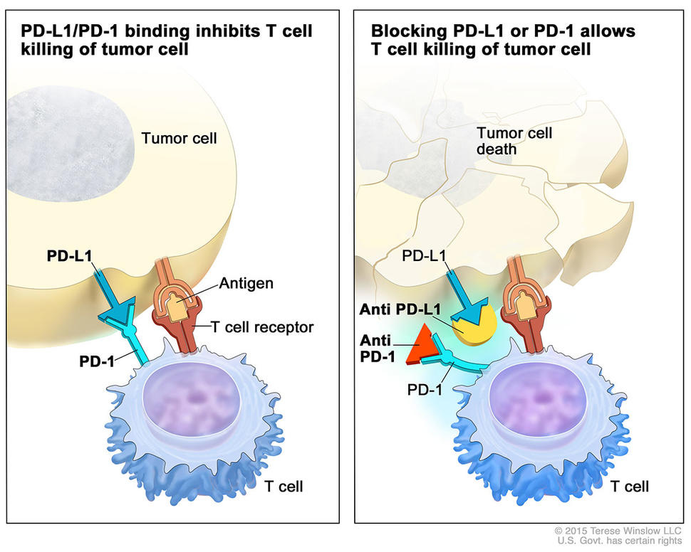 FDA Approves Pembrolizumab to Treat Non-Small Cell Lung Cancer - NCI FDA Approves Pembrolizumab to Treat Non-Small Cell Lung Cancer - NCI