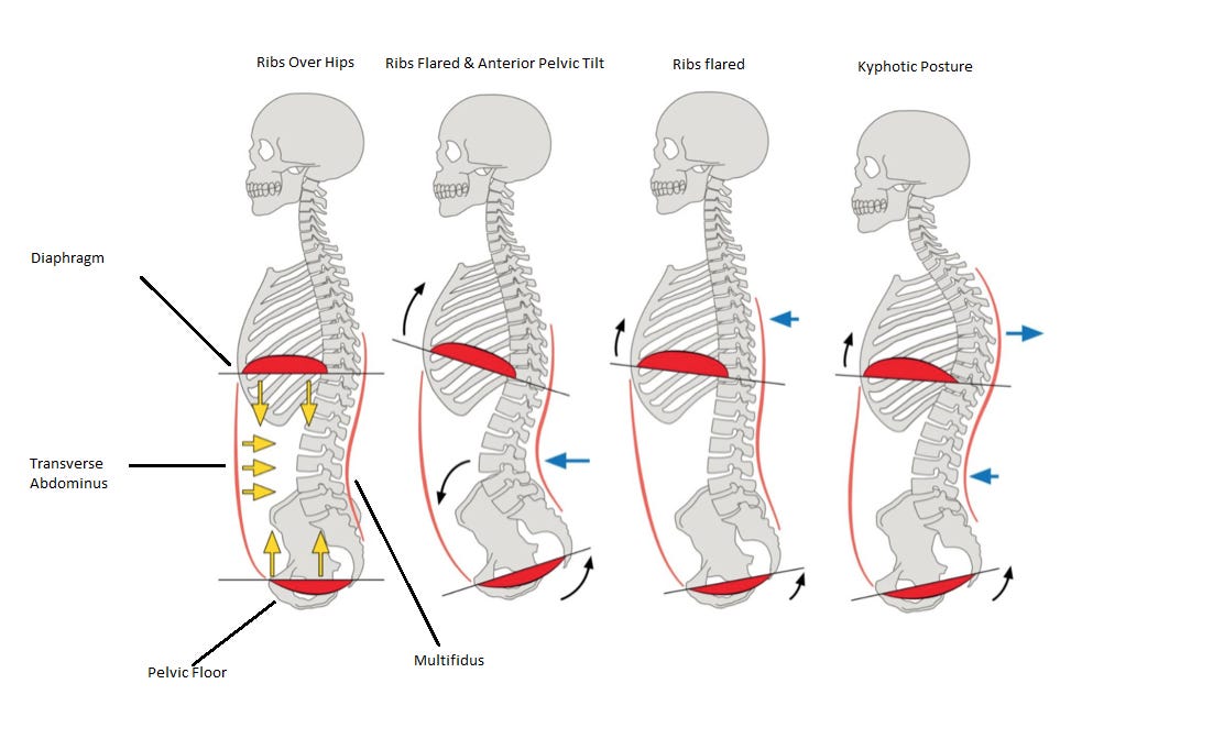 Stop Trying to Fix Your Anterior Pelvic Tilt