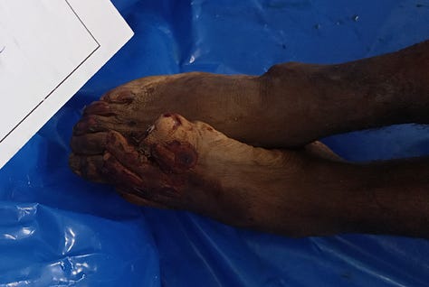 Gaza authorities publish shocking images of Israeli abuse as dozens of unidentified bodies are buried - Palestine Will Be Free